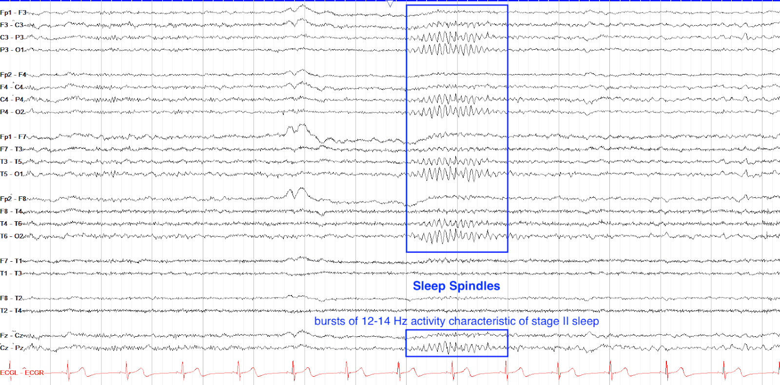EEG Fun Facts Sleep Spindles Feb 17, 2023